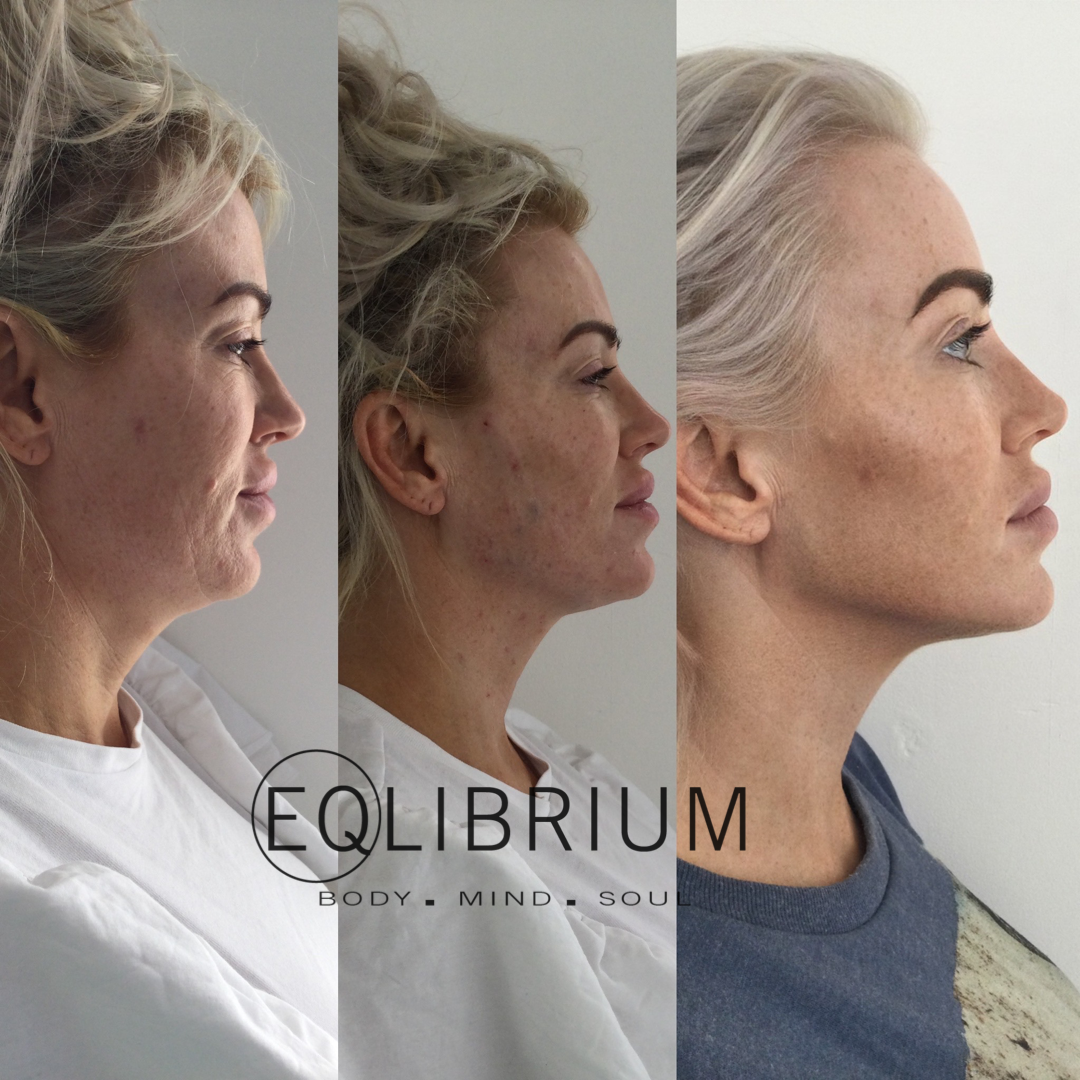 Ready to Become an Elite Aesthetic Practitioner?